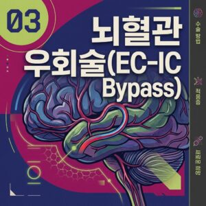 ai thumbnail poster 뇌혈관 우회술EC IC Bypass 1787235064